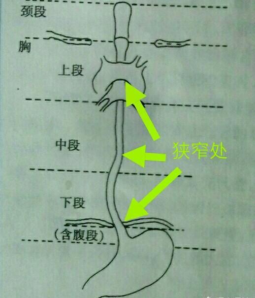 食管癌是怎么引起的呢?在生活中该注意什么的呢?