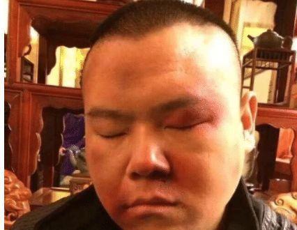 岳云鹏被打成"猪头",惹人心疼,是因为有人带他面具抢劫?