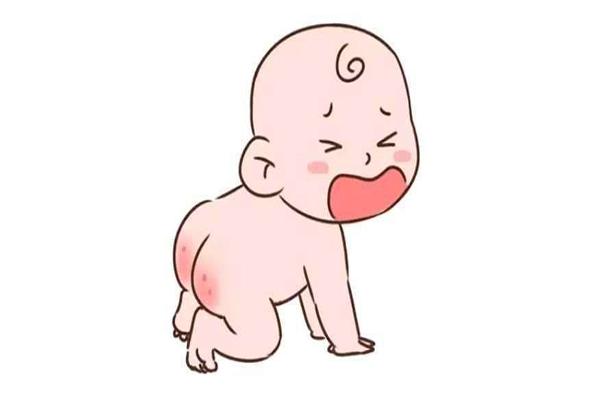 宝宝屁股红怎么办 宝宝屁股红怎样好的快