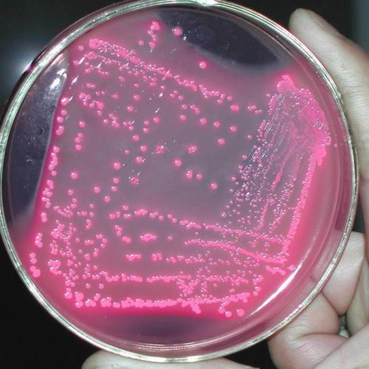 科普知识竞赛#尿酚红排泄试验(psp)是一项用于检查尿液是否正常的