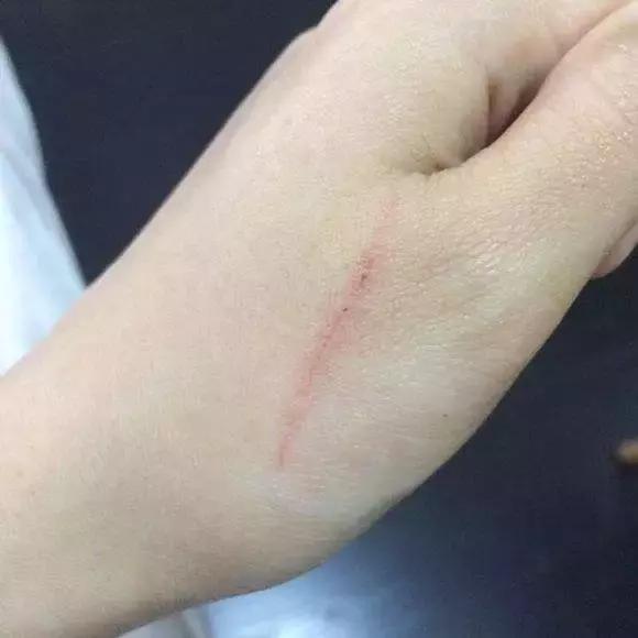 福懋动物医院:被猫抓伤要不要打狂犬疫苗?