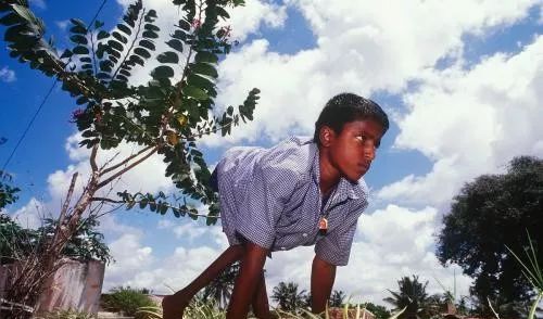 致力于小儿麻痹症儿童康复的国际志愿者项目