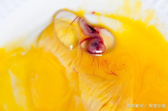 卵黄囊长什么样图片