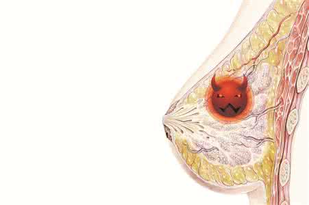 乳腺癌 baijiahao.baidu.com