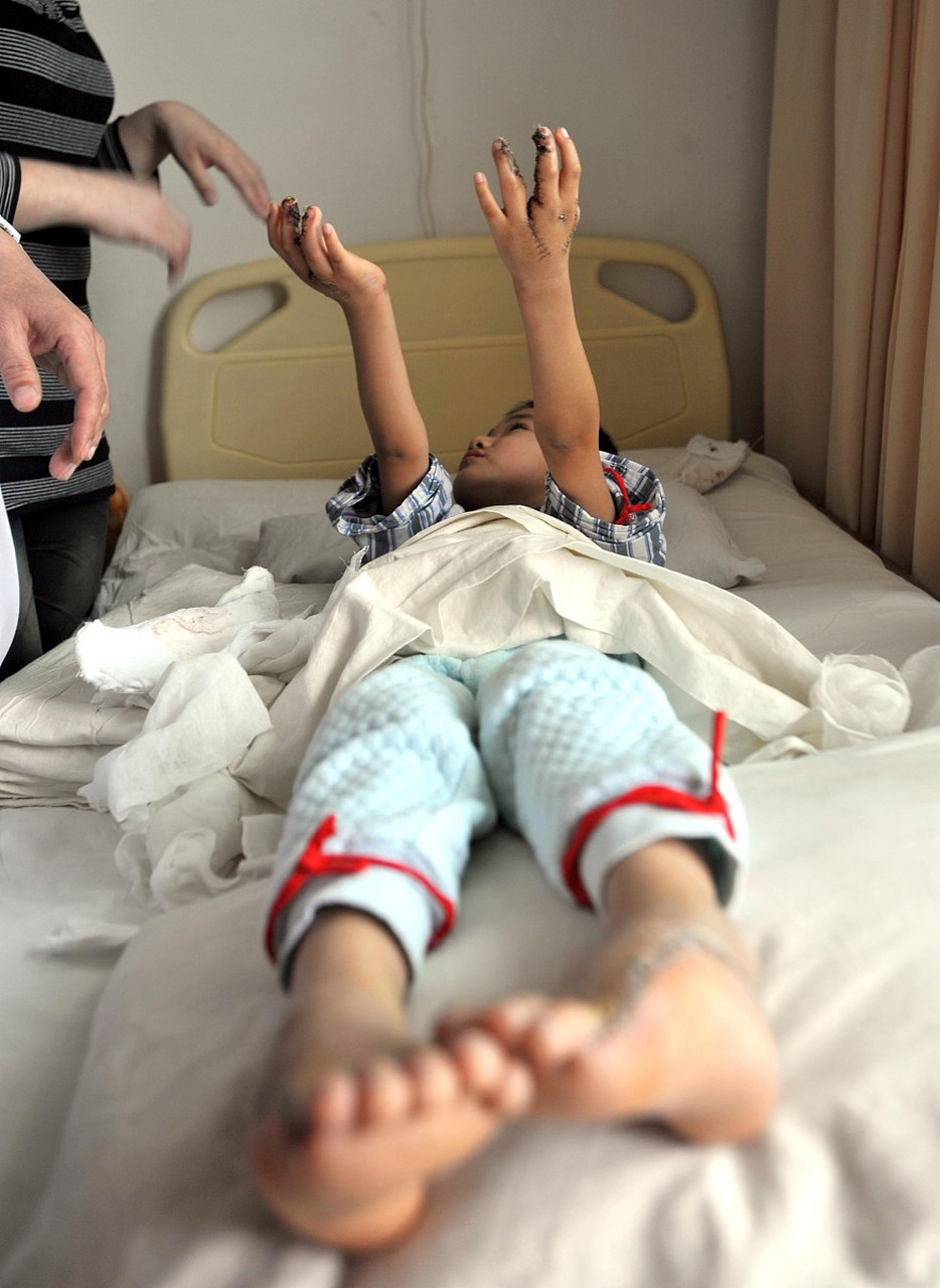 夹腿综合征是病吗	夹腿综合征一般不是病.