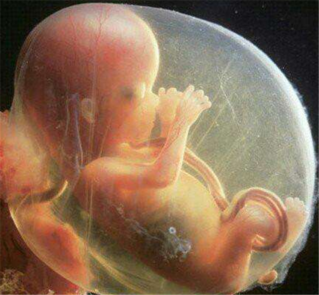 胎宝5个月成型图图片