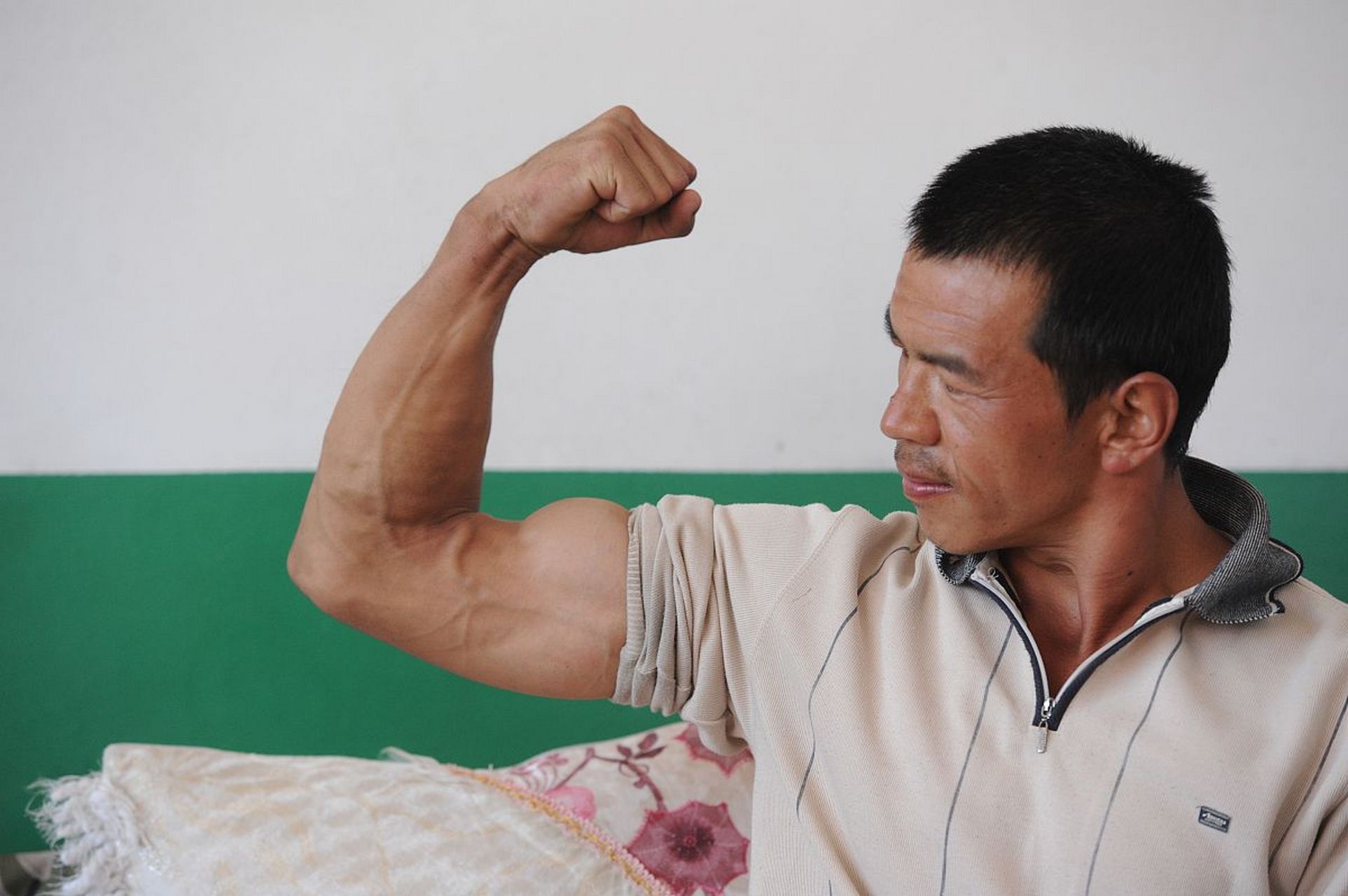 脑梗后偏瘫患者,上肢挎筐问题怎么办?