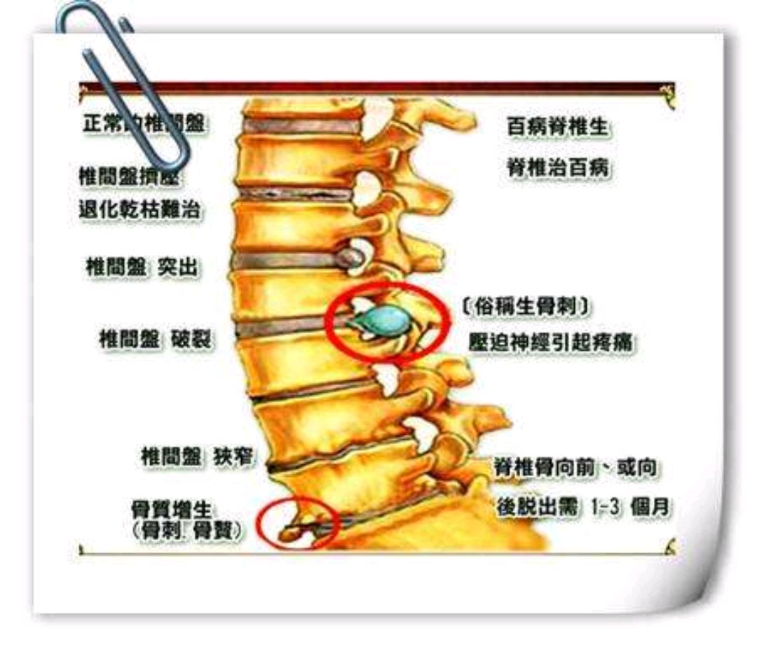 腰椎骨性标志图片
