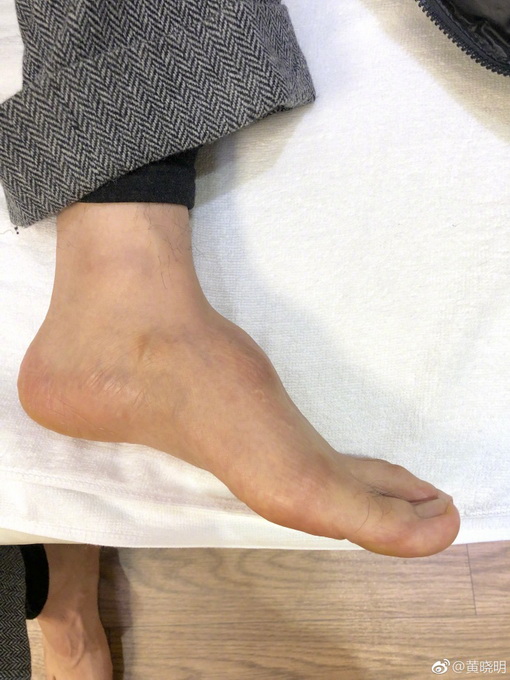 黄晓明回应穿增高鞋垫质疑 他俏皮发问惹网友心疼
