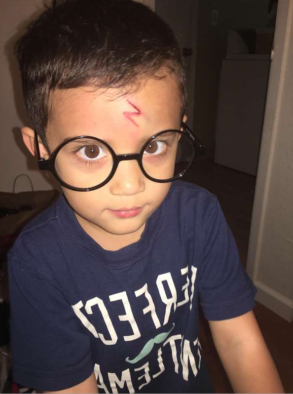 小男孩被割伤又怕丑,妈妈的处理方式,让人竖起大拇指