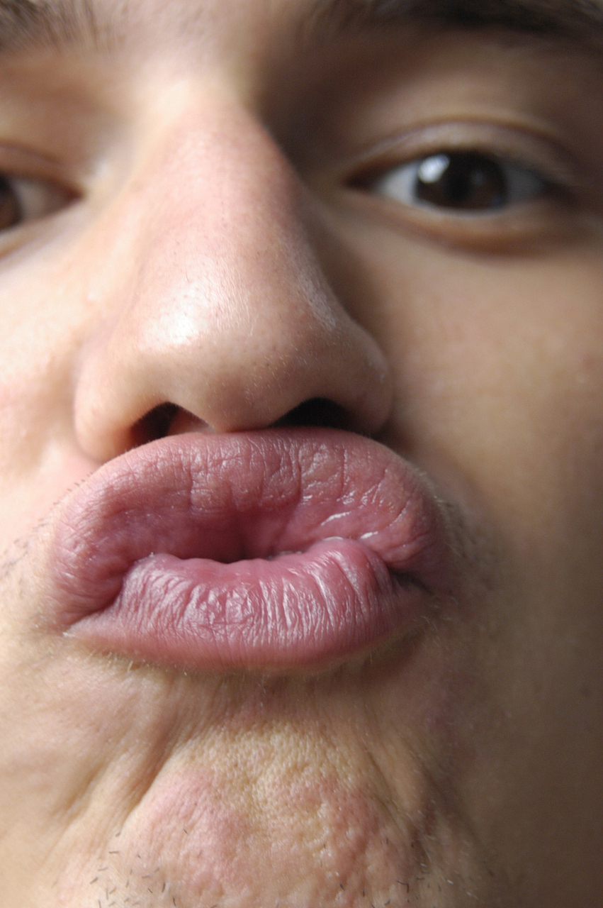 采取适当的方法,但同时也要注意安全性和避免过度刺激娇嫩的嘴唇区域