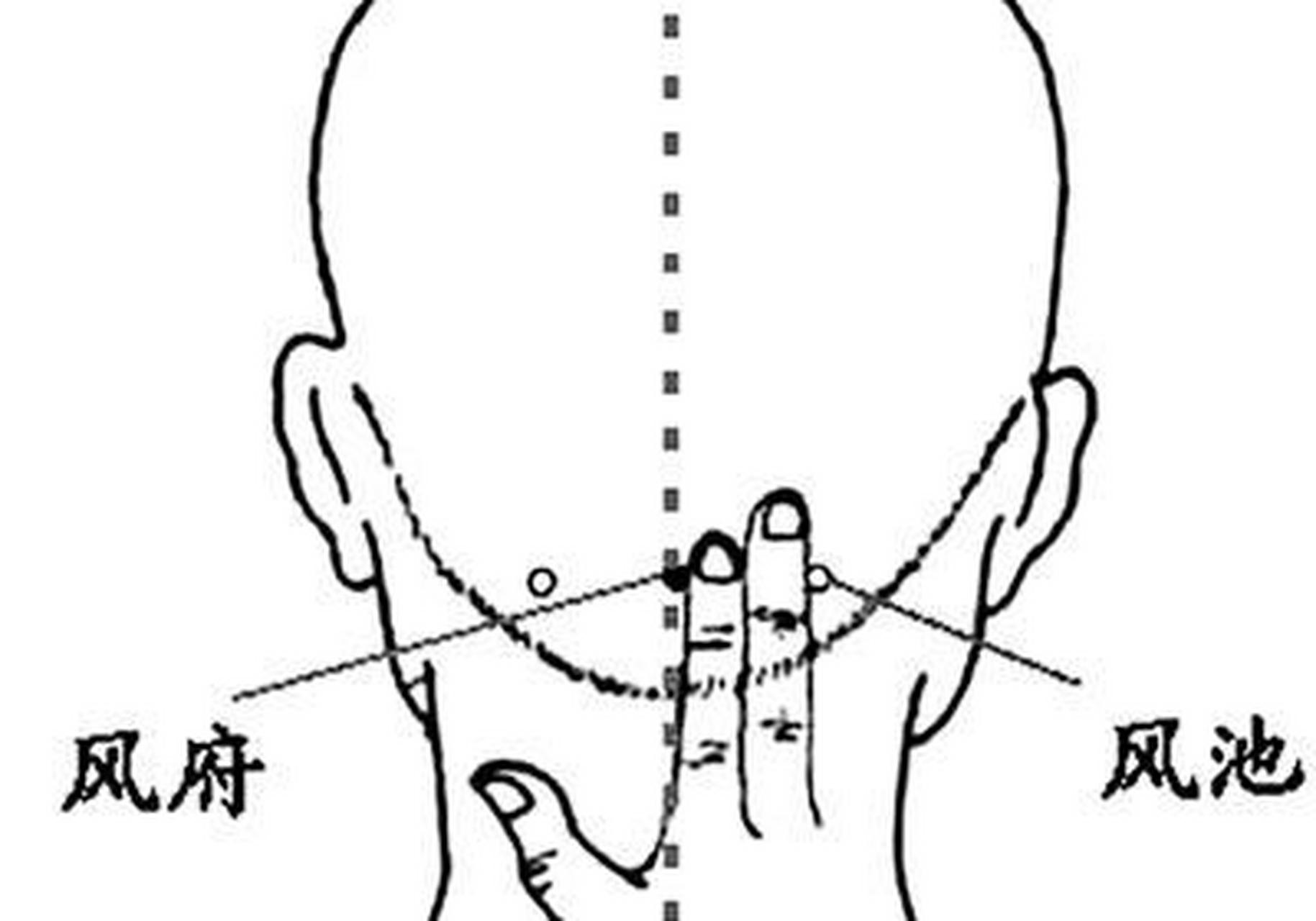 科普知识竞赛#风府穴,别名本穴,鬼穴.属督脉.
