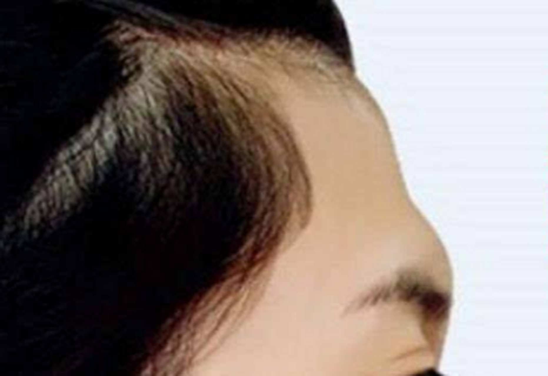 额头是官禄宫,也称事业宫,额头凹陷,读书运与工作运都比较迟滞,考试没