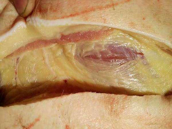 "黄膘猪"形成的原因是什么,其肉到底能不能食用?看完才了解