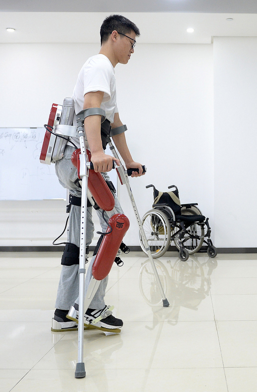 假肢定做#  假肢的更换时间因假肢类型,材料质量,使用情况以及徽哌