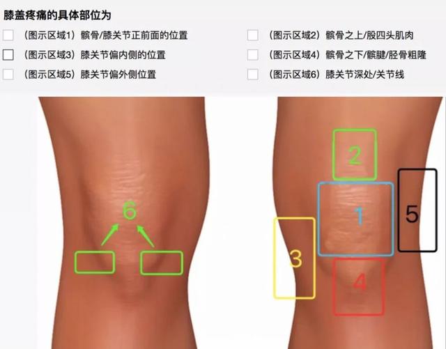 胫骨结节骨软骨病,不是生长痛,12~14岁膝盖下疼痛需要注意
