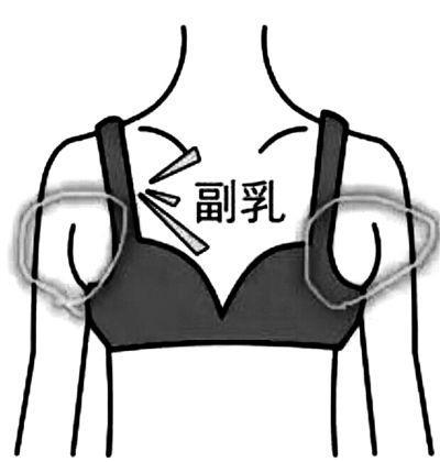 女性副乳疼图片