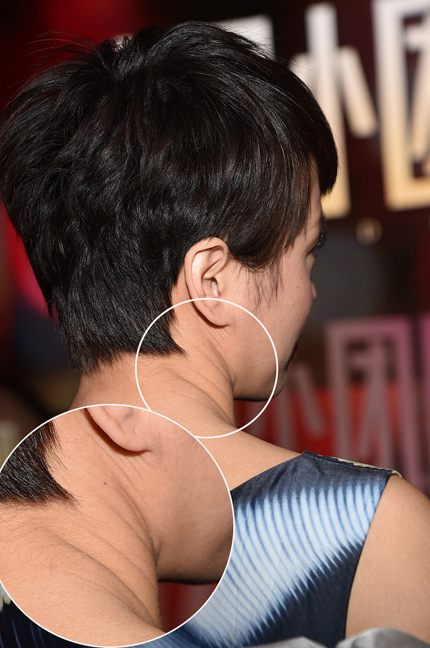 颈纹是许多人的困扰,它们不仅让颈部看起来衰老,也影响整体的容貌.