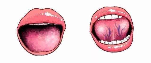 正常舌头下面图片颜色图片