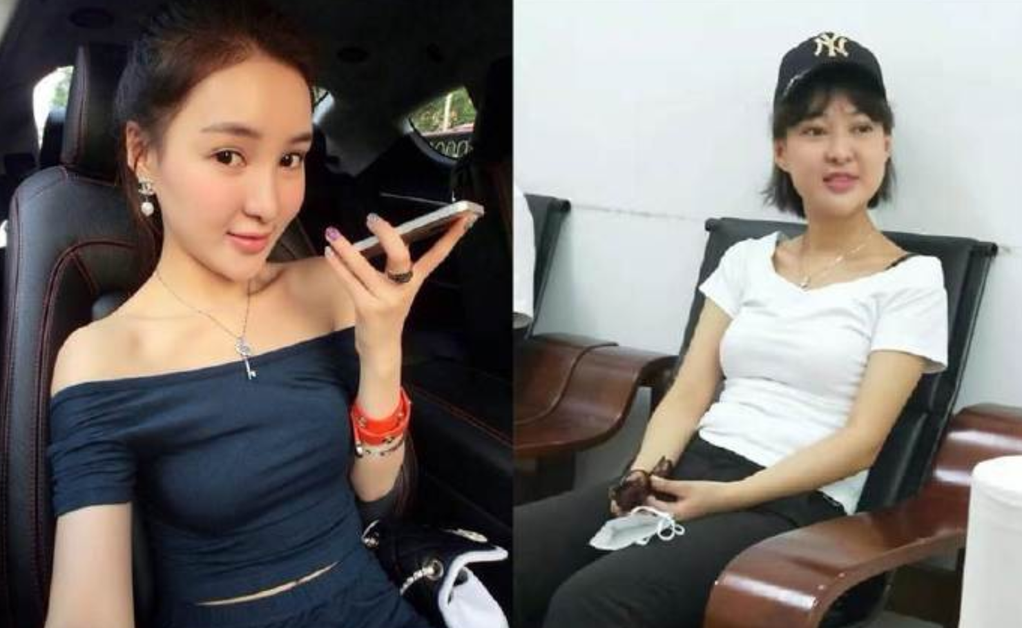 网友晒出郭美美清晰正面照,网红脸不见,脸型回到整容前