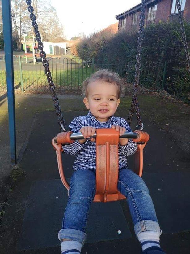 英国12个月大男童打翻蒸笼,热水浇头致三级烧伤,坚强面对治疗