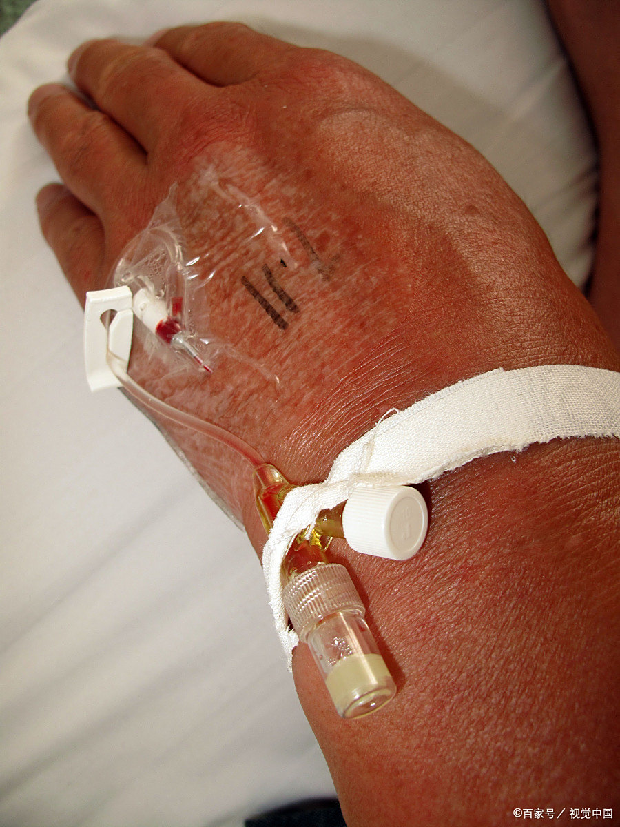 左氧氟沙星针静滴15分钟后,患者突然休克,原因竟然是