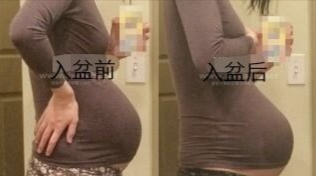 肚子最大的孕妇入盆图片