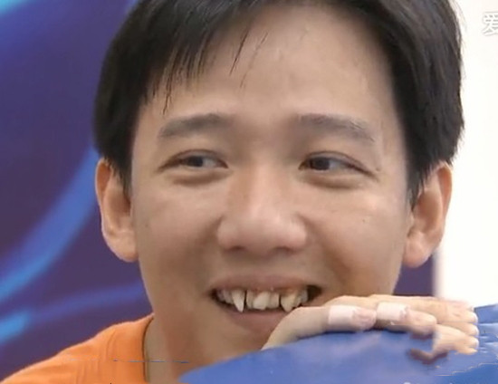 曾因牙丑被妻子嫌弃离婚,现整牙成功,舞台再度亮相帅炸了