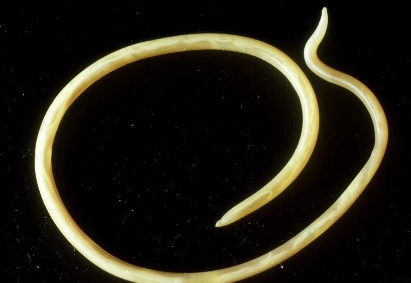 若孩子表现出这几种症状,可能是肚子里有蛔虫,不要忽视了