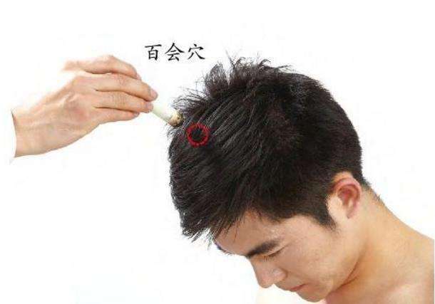 月经期间头晕头痛恶心的艾灸调理方法