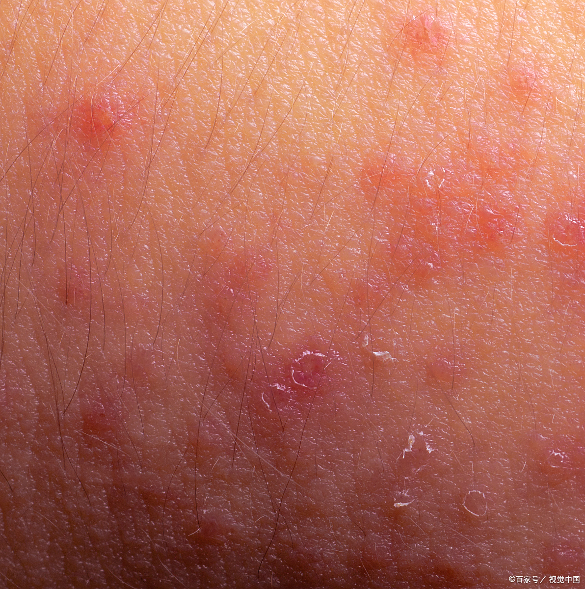 对于过敏性体质的我,每次尝试吃一种新食物,都是一次冒险