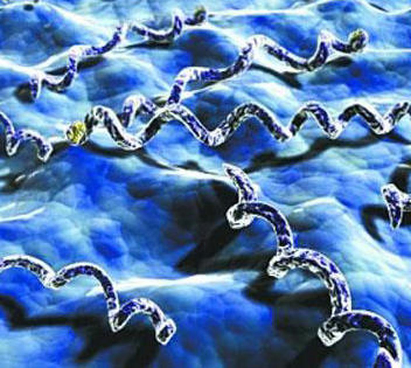 科普知识竞赛#梅毒是由苍白螺旋体感染引起的一种性传播性疾病.