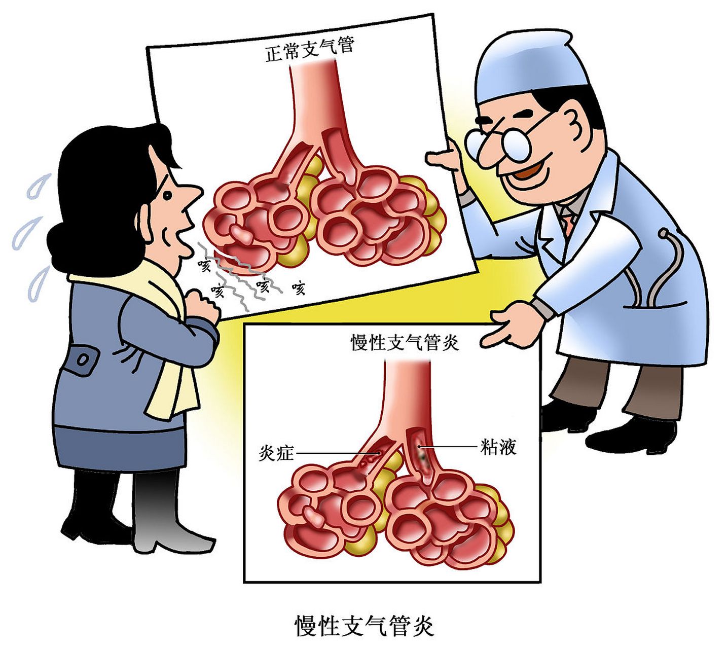 呼吸不畅,慢性支气管炎,肺气肿,用肺力咳胶囊,止咳平喘,清热解毒.