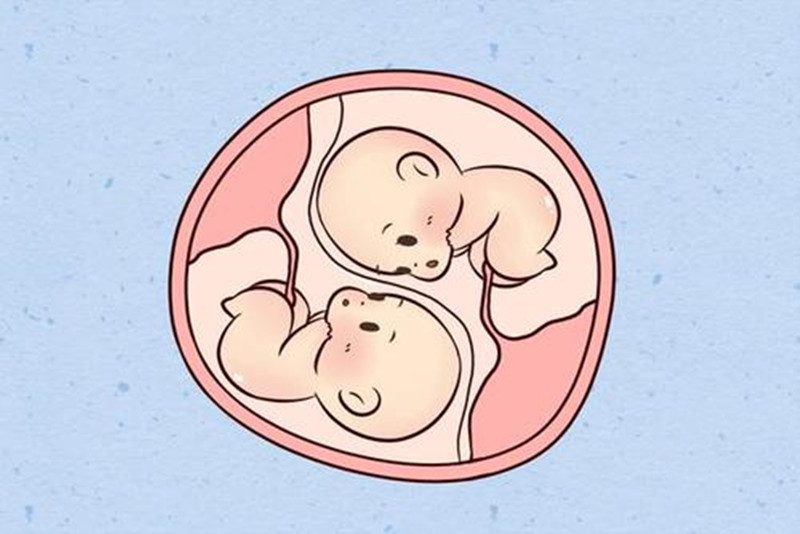 双胞胎孩子长得不像,宝爸怀疑"被绿",检查后宝妈想离婚