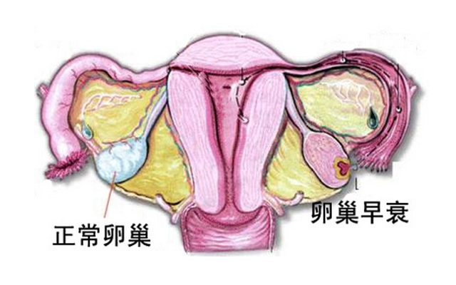 30歲amh值多少為卵巢早衰?不同年齡段正常值介紹