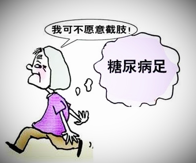 糖尿病足,有4个阶段,专家提示:早发现早治疗,防止足部截肢