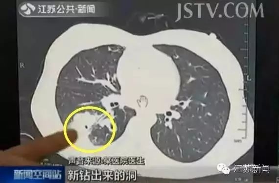 江西人,夜宵界"网红"大量上市!这样做的人,小心吃到"虫"