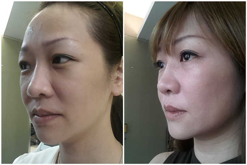 一道法令纹"老十岁",想要摆脱"老阿姨"称号,除皱技巧得知道