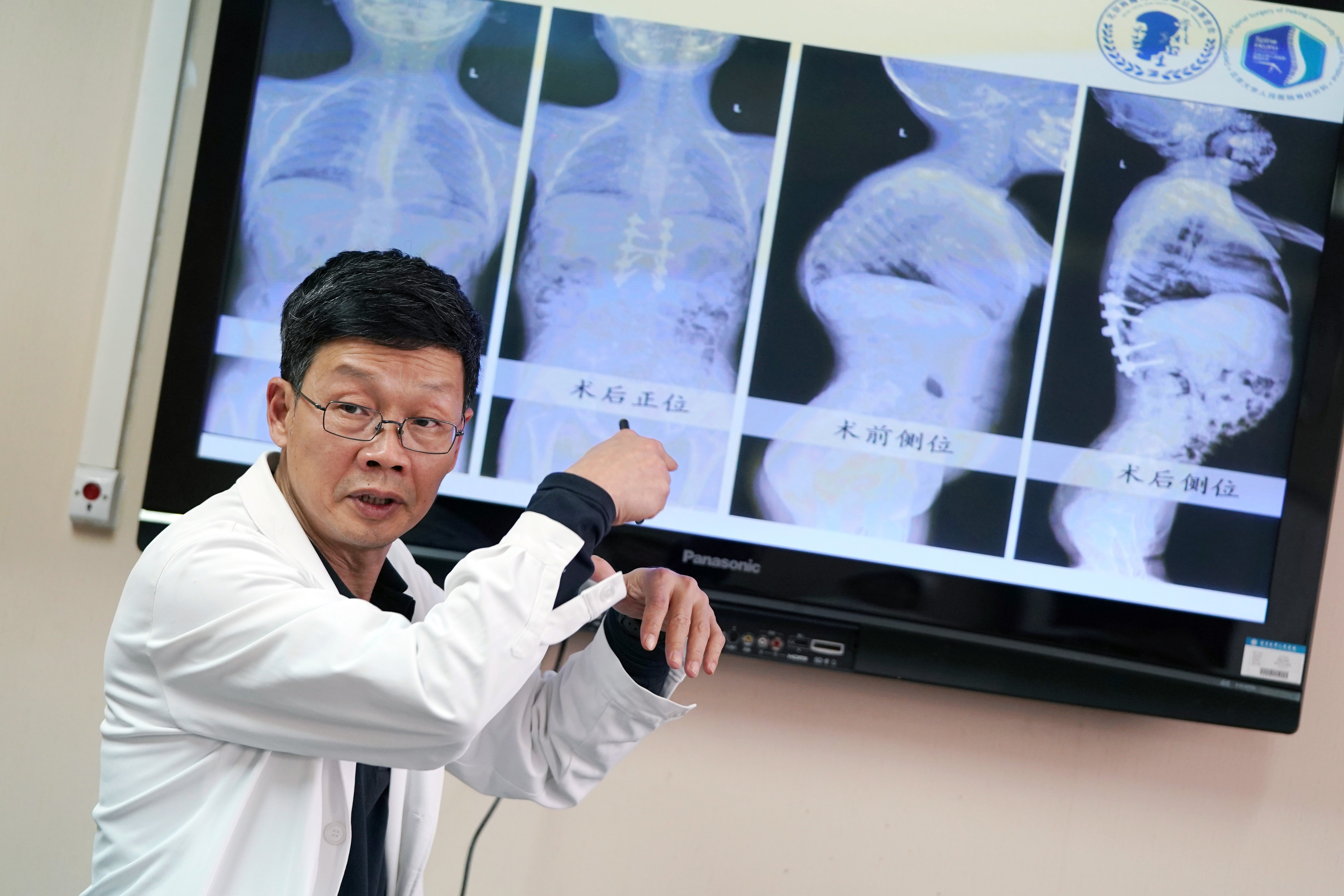 脊柱外科专家刘海鹰:公益大爱帮贫病患者挺直脊梁(1)