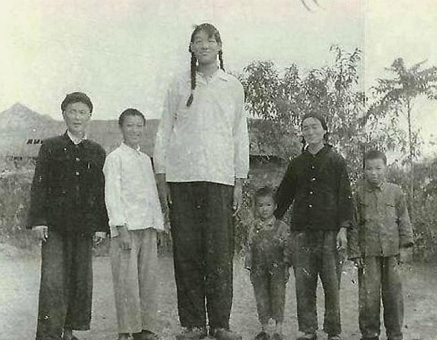 曾金莲:身高2.48米创下世界纪录!18岁突然去世,专家说出原因