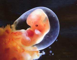 怀孕3个月胎儿停育,孕期这些因素要避免,孕妈牢记胎儿安全