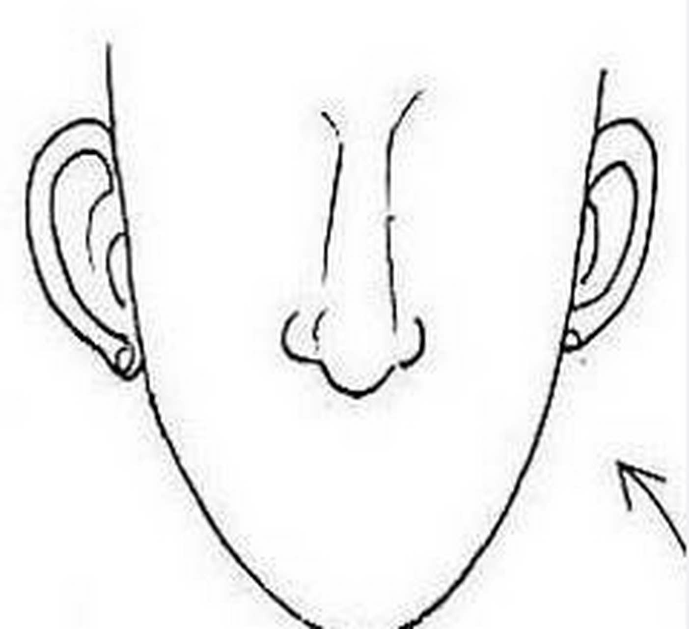 面相两颧凹瘪,无肉,整张脸只剩下一个大鼻子耸立,这种面相叫做孤峰独