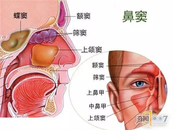 蝶窦图解图片