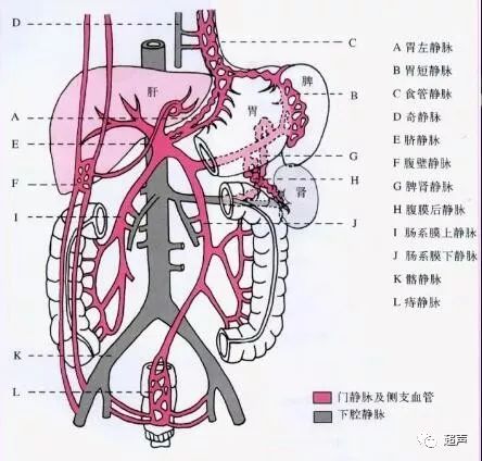 门静脉高压侧支循环示意图