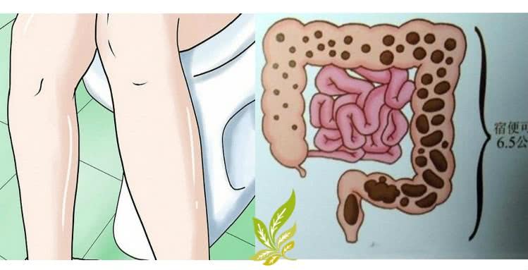 人體腸道有6公斤宿便?醫學專家:胡說八道