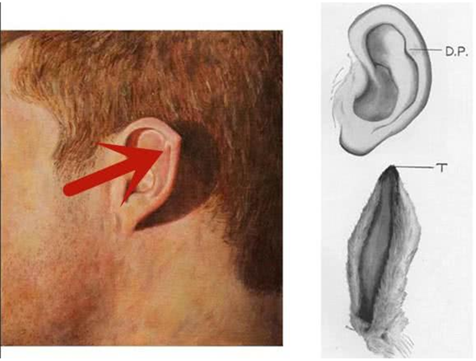 据说达尔文点的主要功能是,它可以聚集吸收更遥远地方的声音.