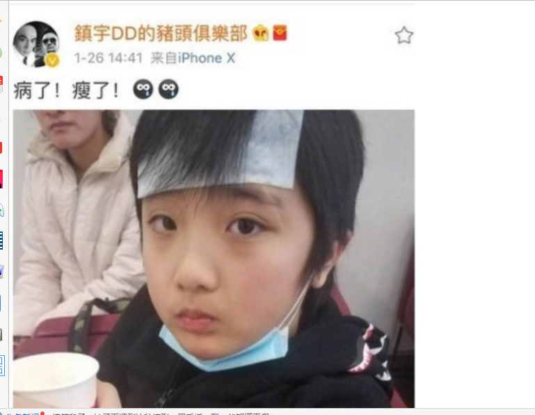 吴镇宇晒费曼憔悴病照,眉眼伤疤很明显,难怪当初气炸毛!