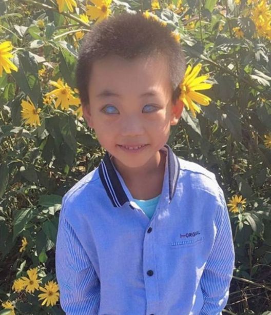 8岁小男孩天生"阴阳眼",被父亲抛弃,医生都束手无策