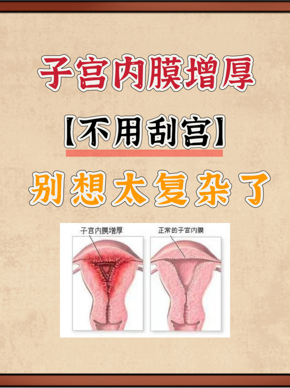 子宫内膜增厚 刮宫图片