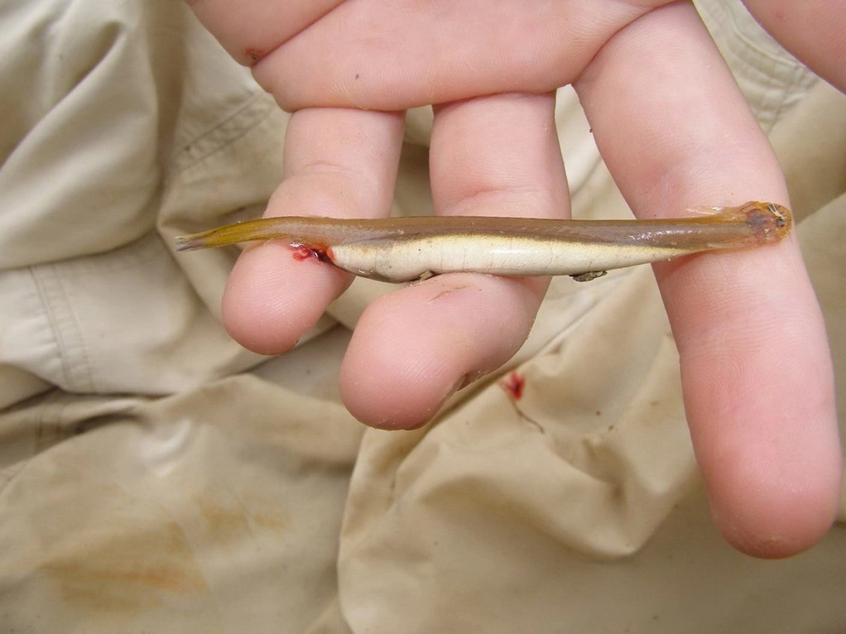 x光发现这种鱼不被人体肠胃所接纳,北美称之为地龙,在我们这里叫泥鳅